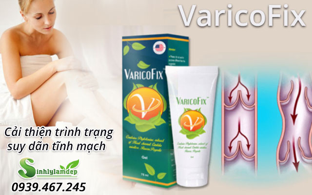 giới thiệu varicofix