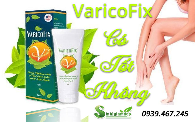 varicofix có tốt không
