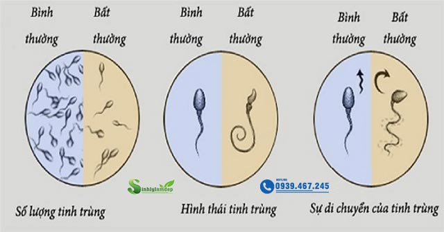 Nhận dạng tinh trùng